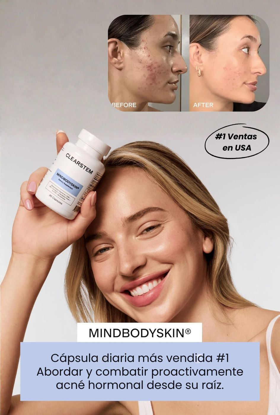CLEARSTEM - MINDBODYSKIN Suplemento hormonal para el acné
